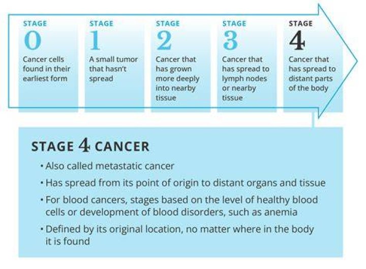 Does Stage 4 cancer automatically qualify for disability?